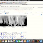 Программа для стоматологии Dental Soft-2:  небольшой обзор
